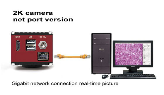 Cámara digital del microscopio de HDMI 60FPS con el interfaz de red del gigabit